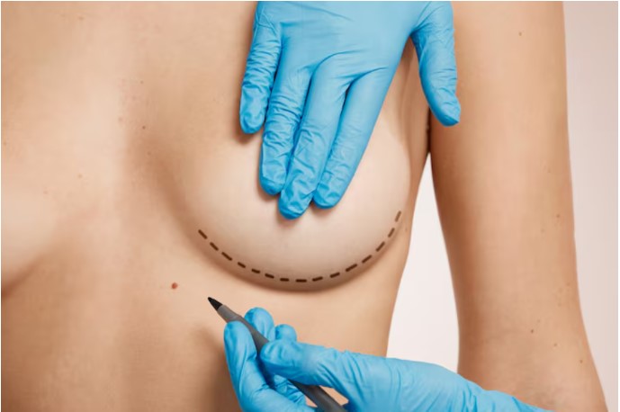 How Breast Implants Can Help You Achieve Your Desired Body Shape How Breast Implants Can Help You Achieve Your Desired Body Shape